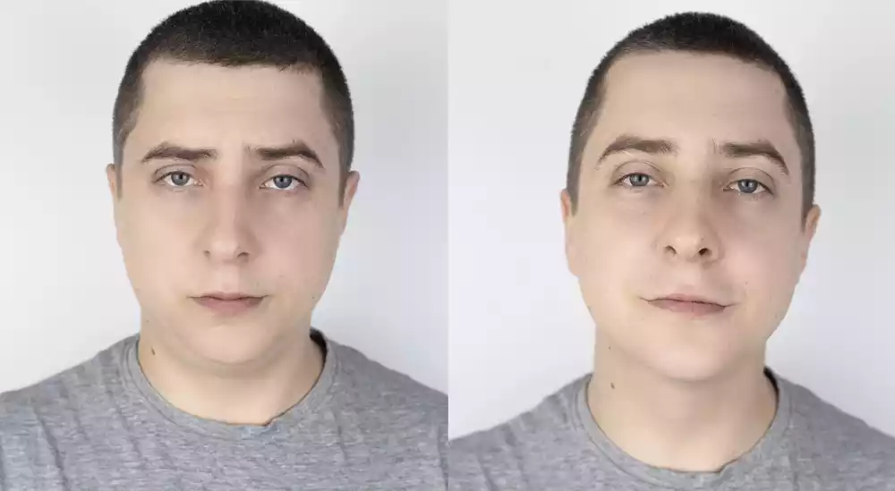 before after
