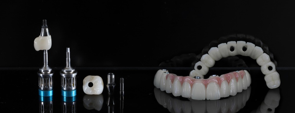 Zygomatic Implants